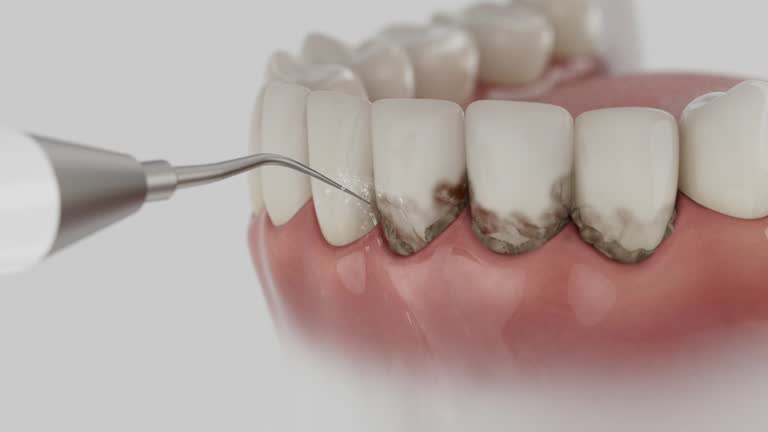Reliable Dental Implants contractor in Trinidad, CO by Smile Center Dentistry